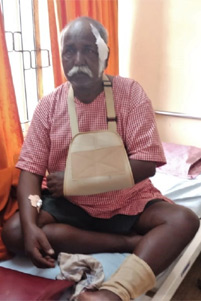 Injured Christian in India. Injured Christian in Maharashtra State, India - Photo: Morning Star News